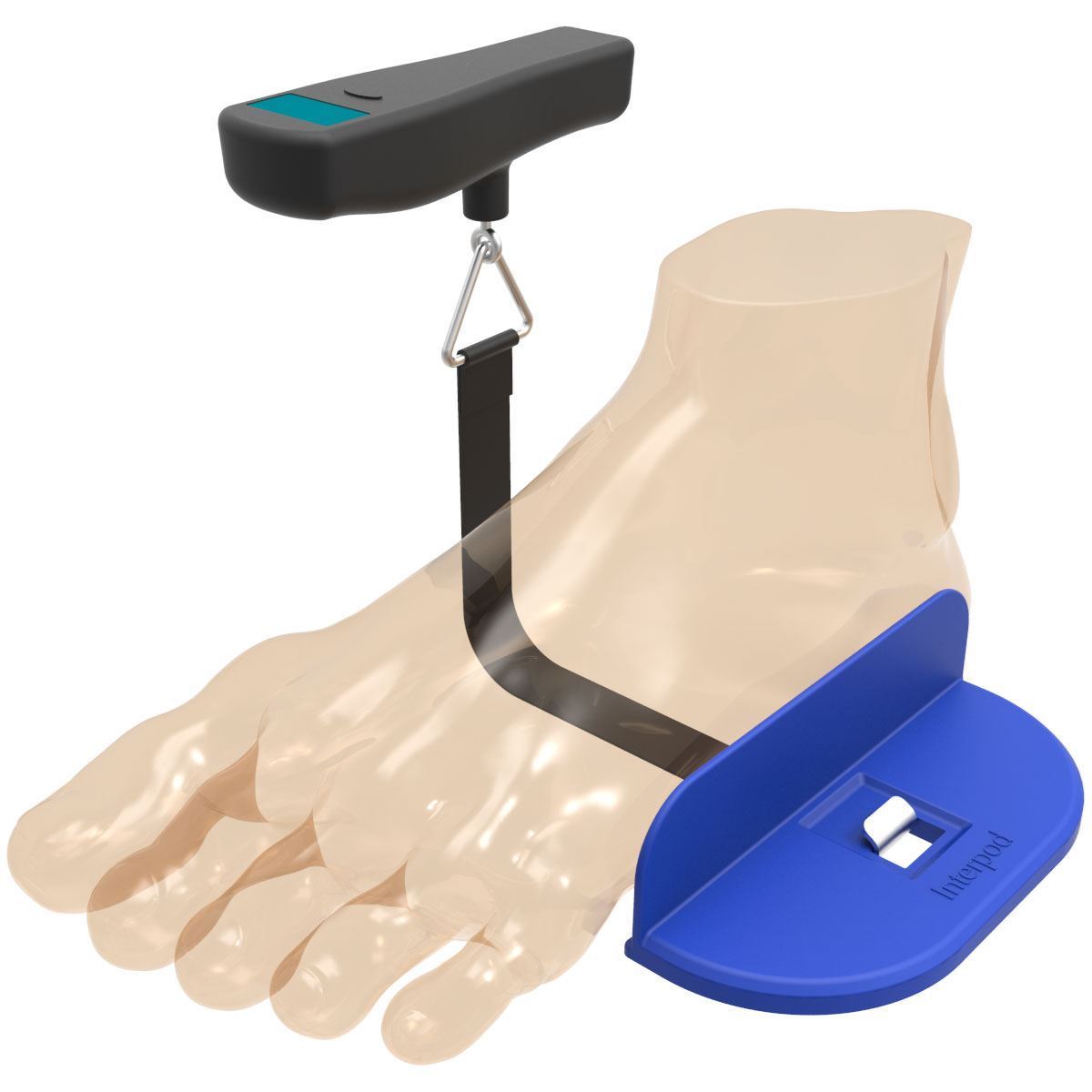 Interpod Keystone Device