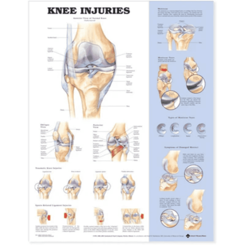 KNEE INJURIES CHART (LAMINATED)