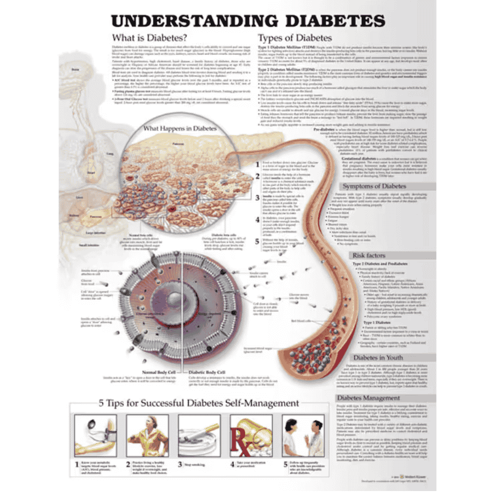 UNDERSTANDING DIABETES ANATOMICAL CHART (LAMINATED
