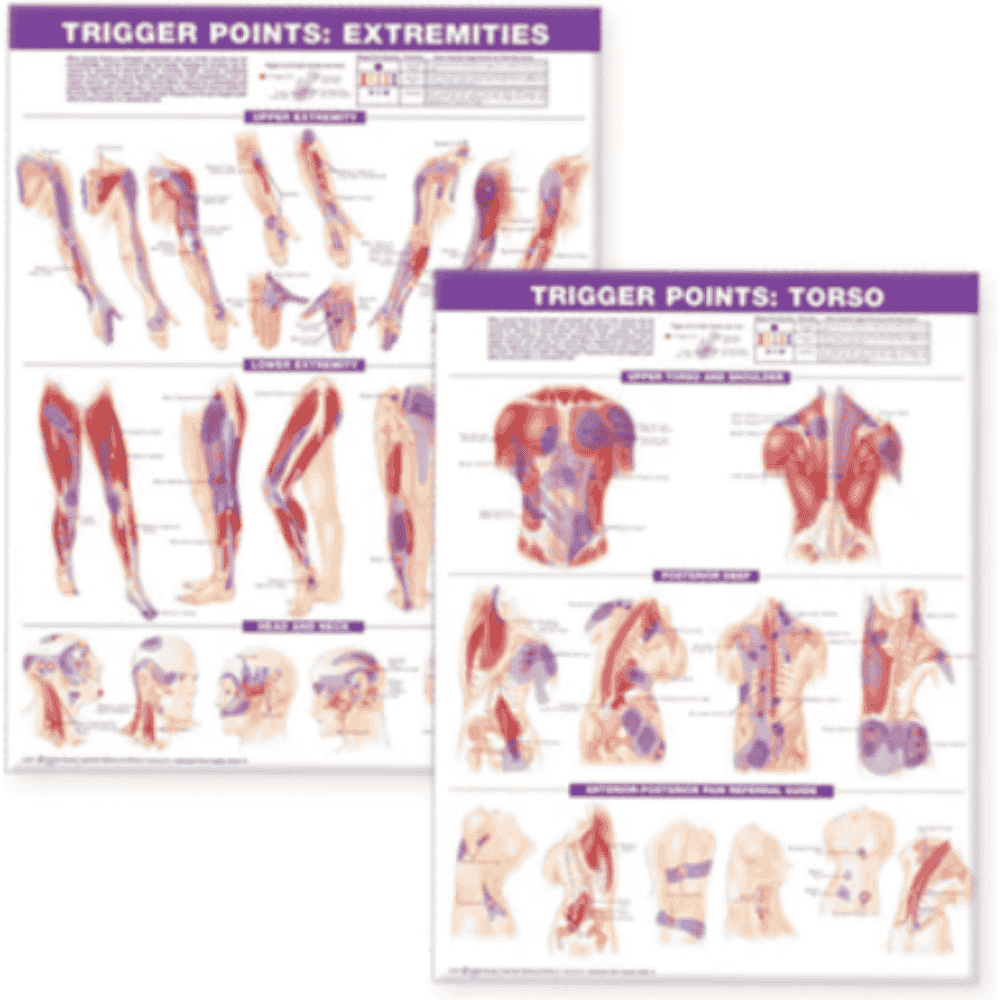TRIGGER POINT CHART SET (LAMINATED)