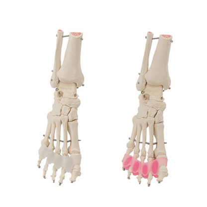 Flamingo Feet Toe Spreaders