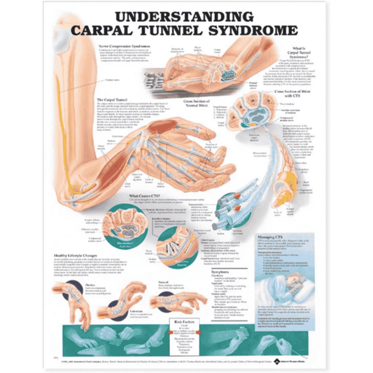 UNDERSTANDING CARPAL TUNNEL (LAMINATED)